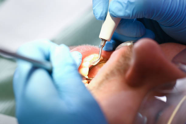 Best Emergency Tooth Extraction  in Whitmore Lake, MI