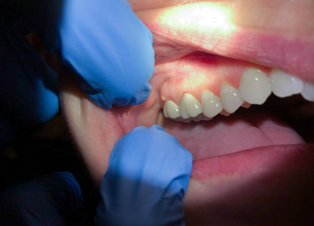 Emergency Dentist for Kids in MI